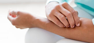 Eczema